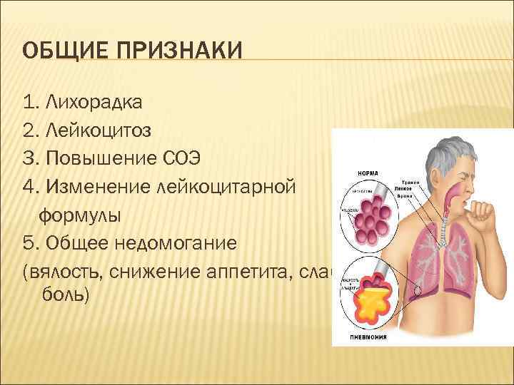 ОБЩИЕ ПРИЗНАКИ 1. Лихорадка 2. Лейкоцитоз 3. Повышение СОЭ 4. Изменение лейкоцитарной формулы 5.