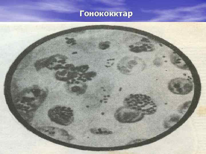 Гонококктар 
