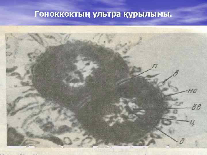 Гоноккоктың ультра құрылымы. 