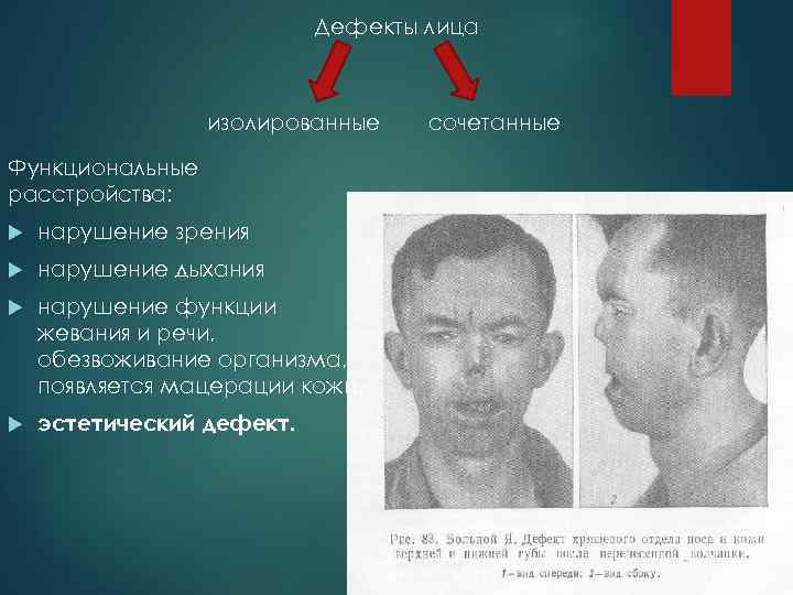 Дефекты лица изолированные Функциональные расстройства: нарушение зрения нарушение дыхания нарушение функции жевания и речи,
