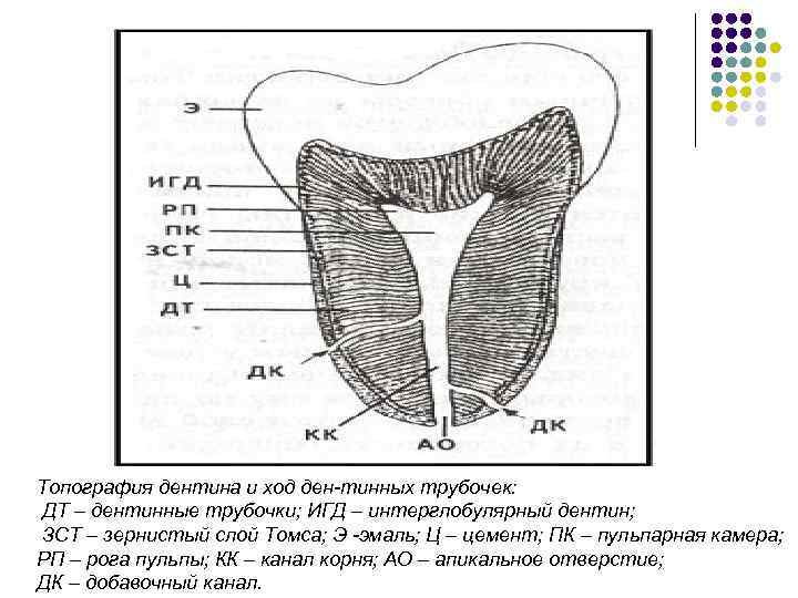 Топография дентина и ход ден-тинных трубочек: ДТ – дентинные трубочки; ИГД – интерглобулярный дентин;