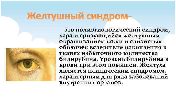 Желтушный синдромэто полиэтиологический синдром, характеризующийся желтушным окрашиванием кожи и слизистых оболочек вследствие накопления в