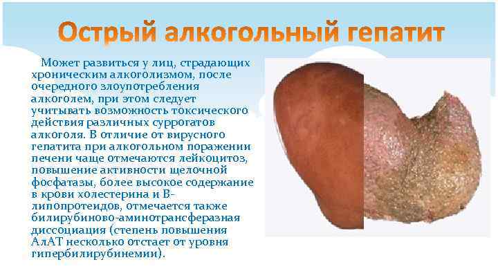 Может развиться у лиц, страдающих хроническим алкоголизмом, после очередного злоупотребления алкоголем, при этом следует