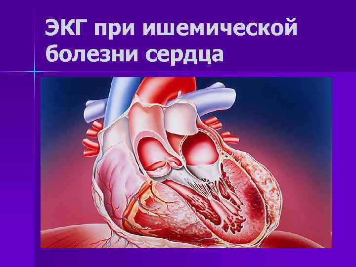 ЭКГ при ишемической болезни сердца 