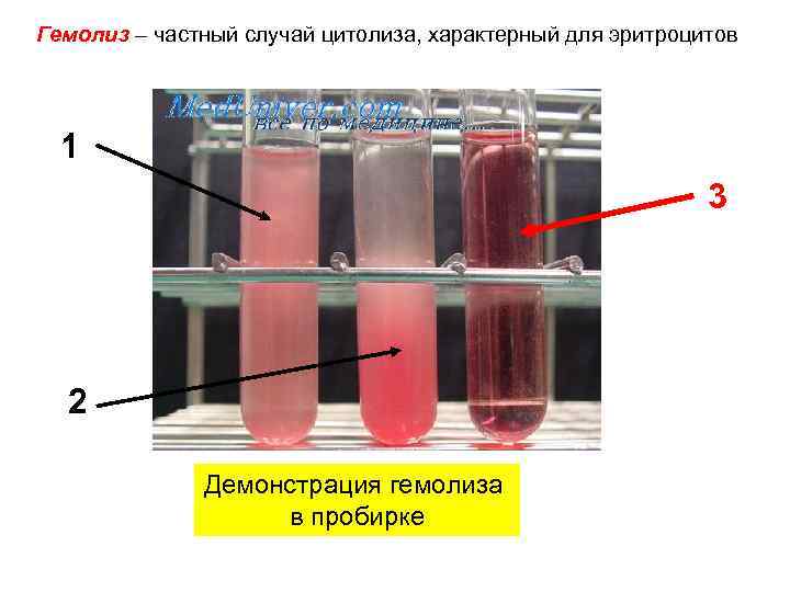 Гемолиз – частный случай цитолиза, характерный для эритроцитов 1 3 2 Демонстрация гемолиза в