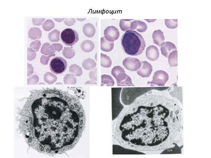 Лимфоцит 
