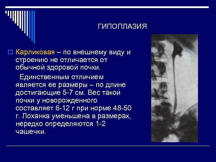 ГИПОПЛАЗИЯ o Карликовая – по внешнему виду и строению не отличается от обычной здоровой
