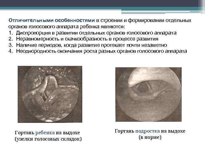 Отличительными особенностями в строении и формировании отдельных органов голосового аппарата ребенка являются: 1. Диспропорция