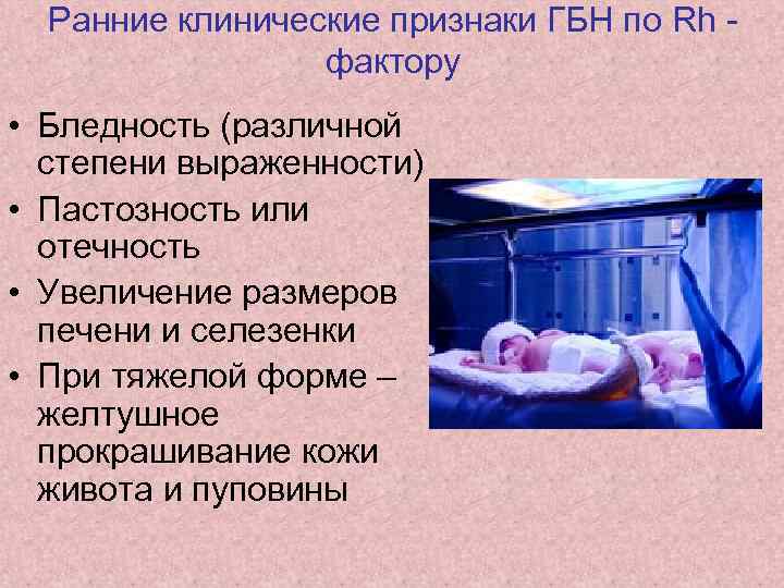 Ранние клинические признаки ГБН по Rh фактору • Бледность (различной степени выраженности) • Пастозность