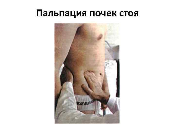 Пальпация почек стоя 