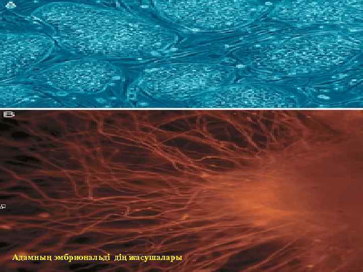 Адамның эмбриональді дің жасушалары 