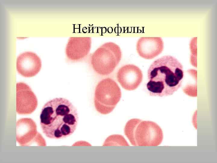 Нейтрофилы 