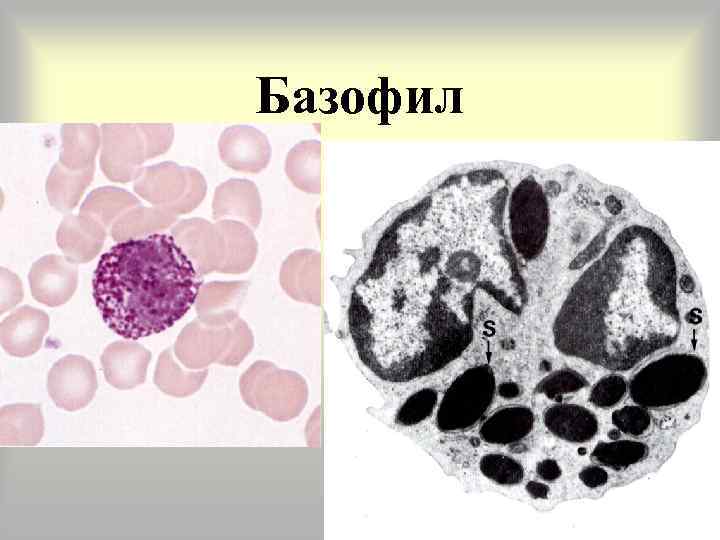 Базофил 