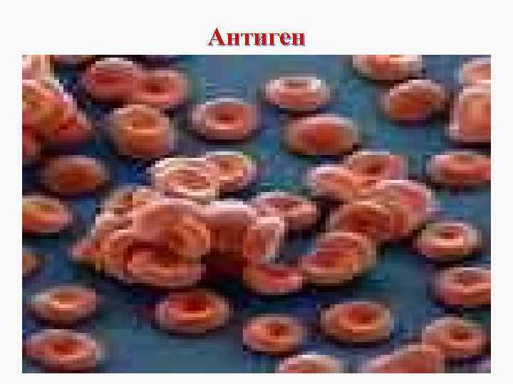 Антиген 