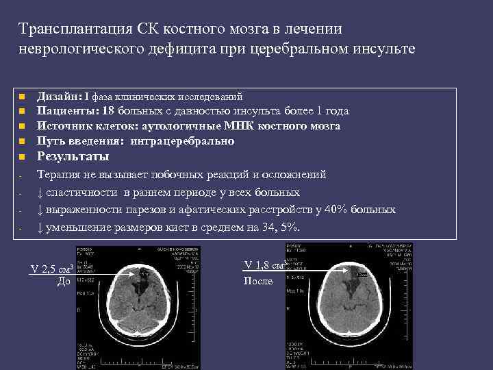 Трансплантация СК костного мозга в лечении неврологического дефицита при церебральном инсульте n Дизайн: I