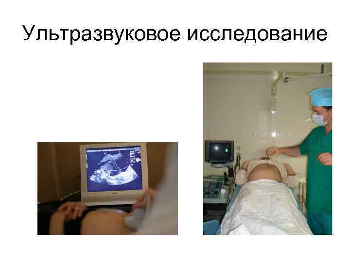 Ультразвуковое исследование 