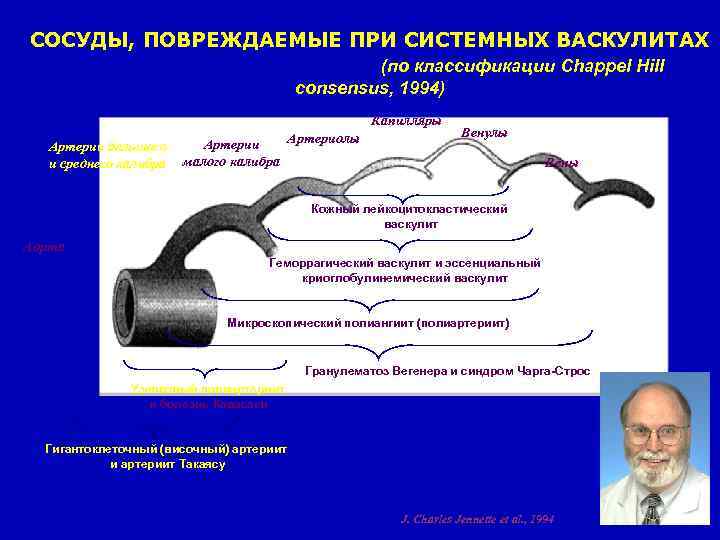 СОСУДЫ, ПОВРЕЖДАЕМЫЕ ПРИ СИСТЕМНЫХ ВАСКУЛИТАХ (по классификации Chappel Hill consensus, 1994) Капилляры Артерии большого