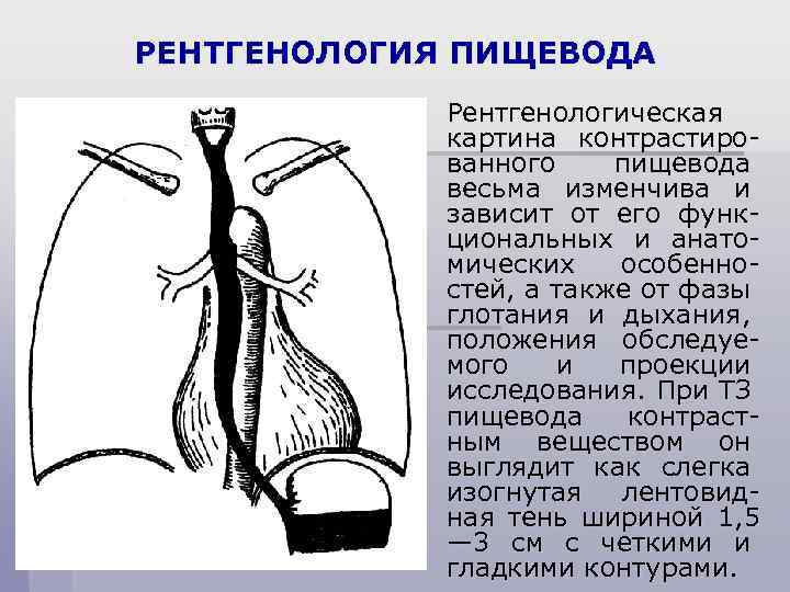 РЕНТГЕНОЛОГИЯ ПИЩЕВОДА Рентгенологическая картина контрастированного пищевода весьма изменчива и зависит от его функциональных и