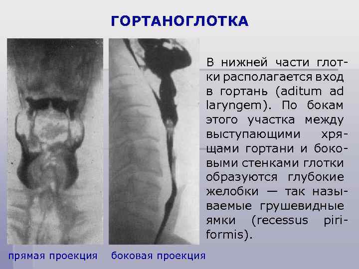 ГОРТАНОГЛОТКА В нижней части глотки располагается вход в гортань (aditum ad laryngem). По бокам