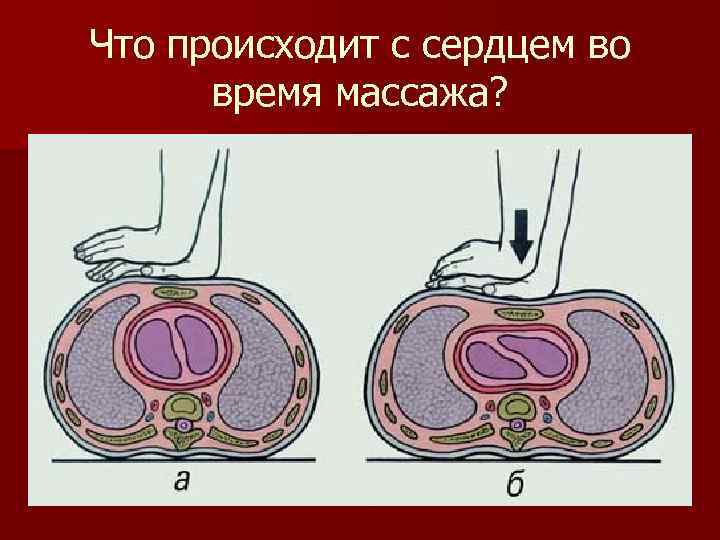 Что происходит с сердцем во время массажа? 