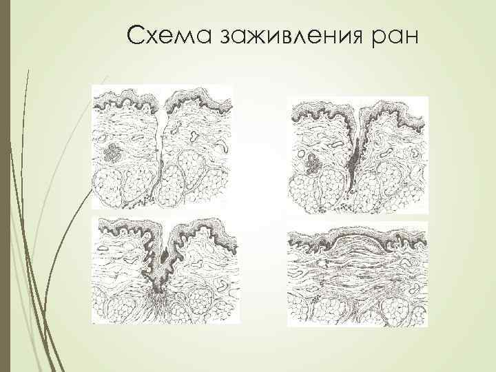 Схема заживления ран 