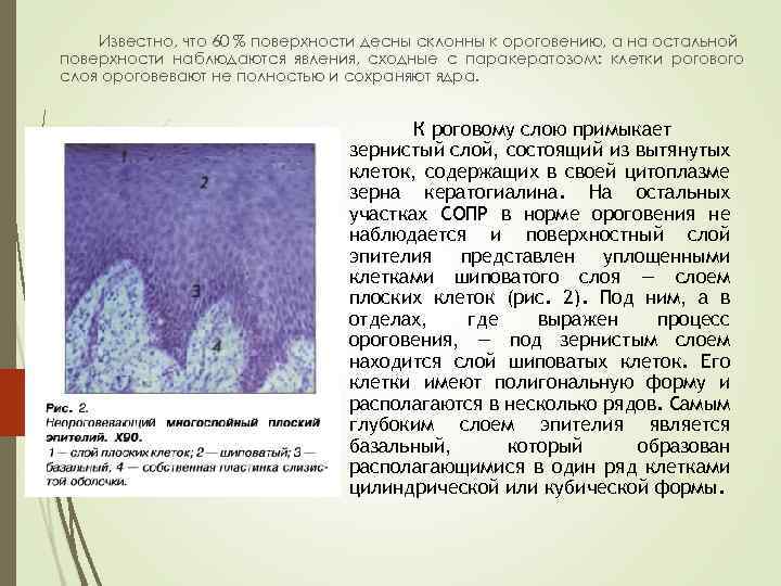Известно, что 60 % поверхности десны склонны к ороговению, а на остальной поверхности наблюдаются