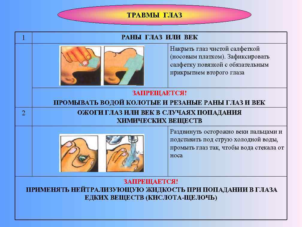 ТРАВМЫ ГЛАЗ 1 РАНЫ ГЛАЗ ИЛИ ВЕК Накрыть глаз чистой салфеткой (носовым платком). Зафиксировать