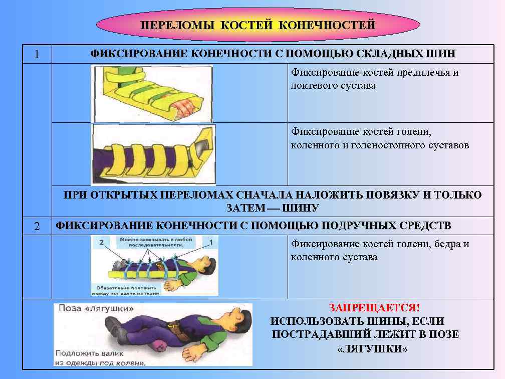ПЕРЕЛОМЫ КОСТЕЙ КОНЕЧНОСТЕЙ 1 ФИКСИРОВАНИЕ КОНЕЧНОСТИ С ПОМОЩЬЮ СКЛАДНЫХ ШИН Фиксирование костей предплечья и