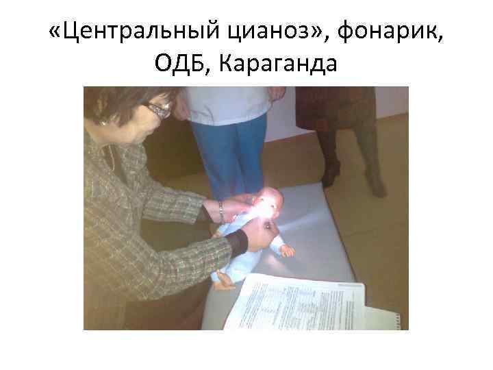 «Центральный цианоз» , фонарик, ОДБ, Караганда 
