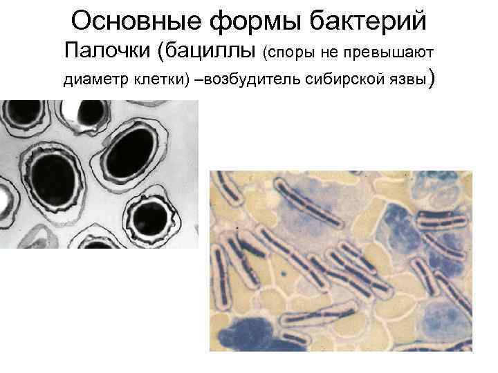 Основные формы бактерий Палочки (бациллы (споры не превышают диаметр клетки) –возбудитель сибирской язвы) 