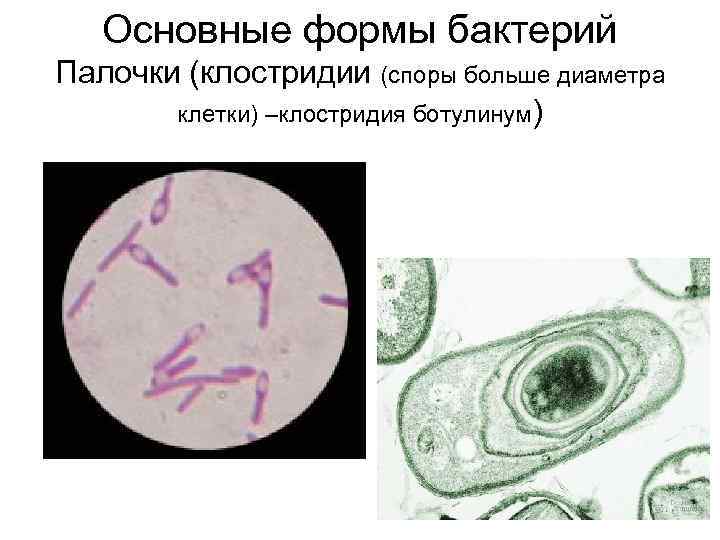 Основные формы бактерий Палочки (клостридии (споры больше диаметра клетки) –клостридия ботулинум) 