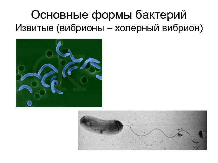 Основные формы бактерий Извитые (вибрионы – холерный вибрион) 