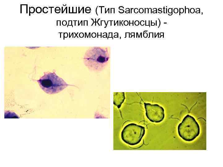 Простейшие (Тип Sarcomastigophoa, подтип Жгутиконосцы) трихомонада, лямблия 