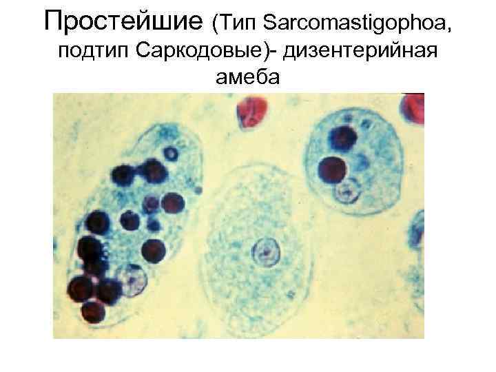 Простейшие (Тип Sarcomastigophoa, подтип Саркодовые)- дизентерийная амеба 
