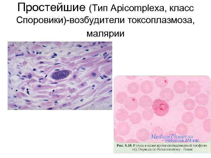 Простейшие (Тип Apicomplexa, класс Споровики)-возбудители токсоплазмоза, малярии 