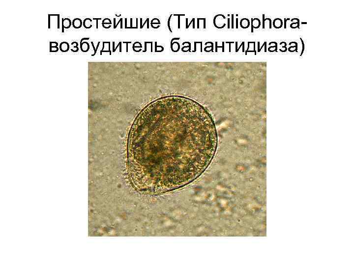 Простейшие (Тип Ciliophoraвозбудитель балантидиаза) 
