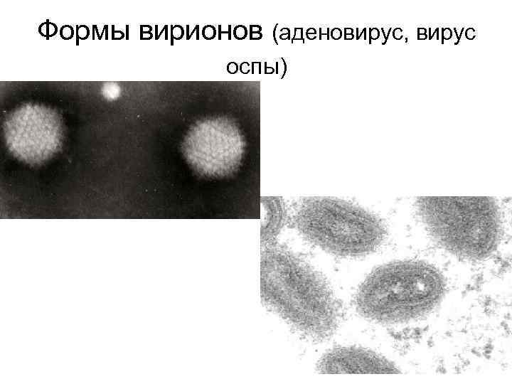 Формы вирионов (аденовирус, вирус оспы) 