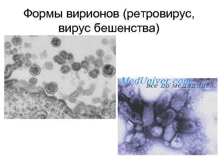 Формы вирионов (ретровирус, вирус бешенства) 