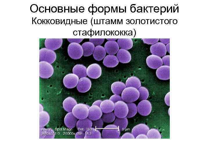 Основные формы бактерий Кокковидные (штамм золотистого стафилококка) 