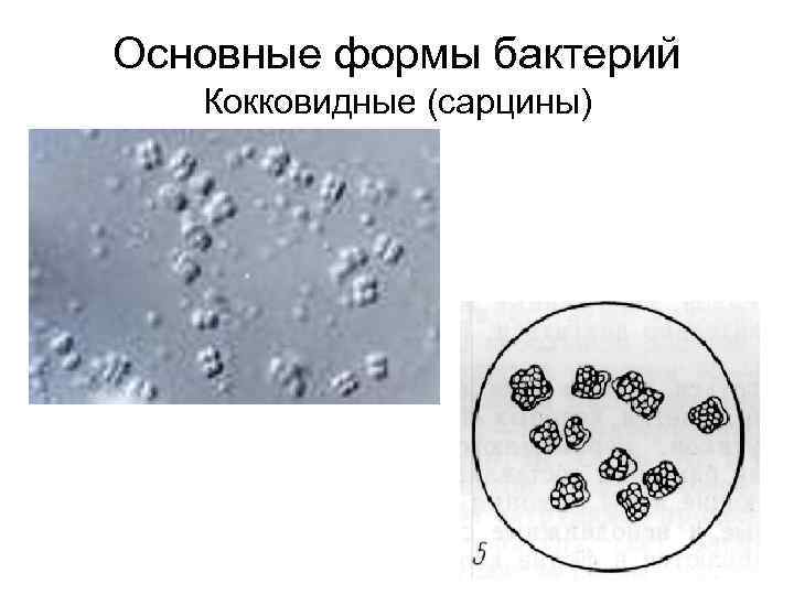 Основные формы бактерий Кокковидные (сарцины) 