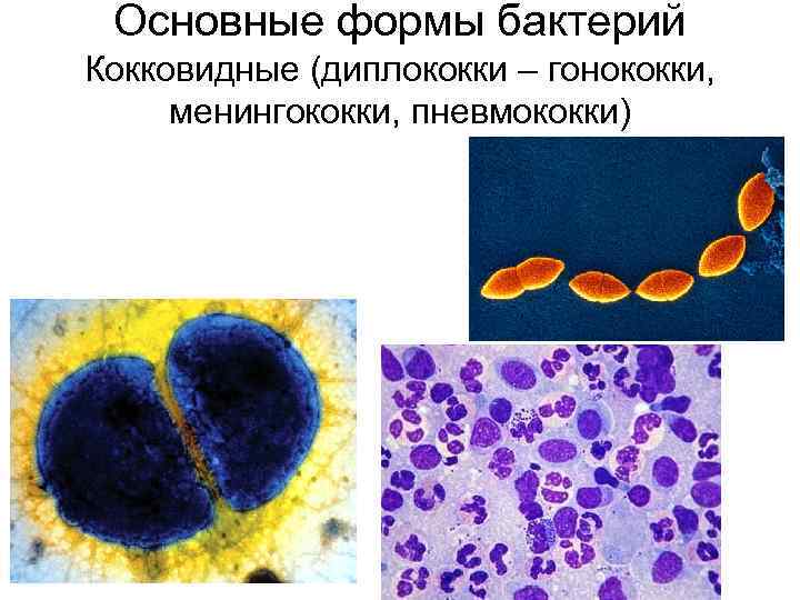 Основные формы бактерий Кокковидные (диплококки – гонококки, менингококки, пневмококки) 