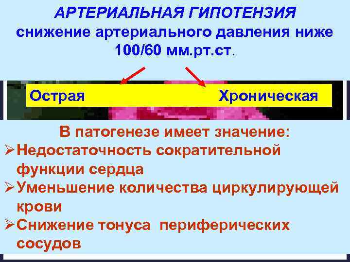 АРТЕРИАЛЬНАЯ ГИПОТЕНЗИЯ снижение артериального давления ниже 100/60 мм. рт. ст. Острая Хроническая В патогенезе
