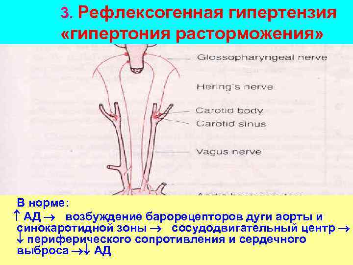3. Рефлексогенная гипертензия «гипертония расторможения» В норме: АД возбуждение барорецепторов дуги аорты и синокаротидной