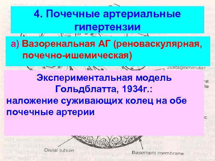 4. Почечные артериальные гипертензии а) Вазоренальная АГ (реноваскулярная, почечно-ишемическая) Экспериментальная модель Гольдблатта, 1934 г.
