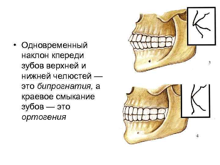 Зубы верхней и нижней челюсти