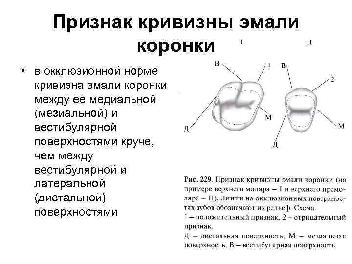 Признак принадлежности. Признаки латерализации зуба. Признак кривизны эмали коронки. Признак кривизны коронки зуба. Признаки принадлежности зуба поверхности коронки зуба.