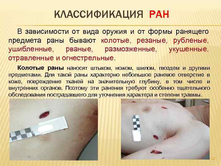 КЛАССИФИКАЦИЯ РАН В зависимости от вида оружия и от формы ранящего предмета раны бывают