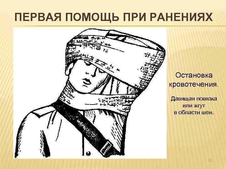 ПЕРВАЯ ПОМОЩЬ ПРИ РАНЕНИЯХ Остановка кровотечения. Давящая повязка или жгут в области шеи. 21