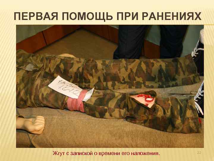 ПЕРВАЯ ПОМОЩЬ ПРИ РАНЕНИЯХ Жгут с запиской о времени его наложения. 22 