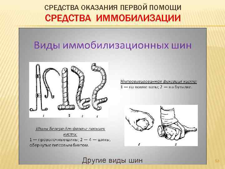 СРЕДСТВА ОКАЗАНИЯ ПЕРВОЙ ПОМОЩИ СРЕДСТВА ИММОБИЛИЗАЦИИ Другие виды шин 53 